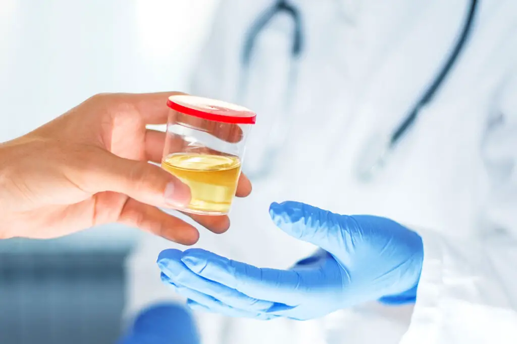 How Long Can You Store Urine for a Drug Test?